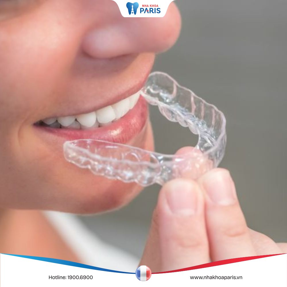 Chuyên gia nói gì về gói niềng Essentials By Invisalign: Bác sĩ trâm