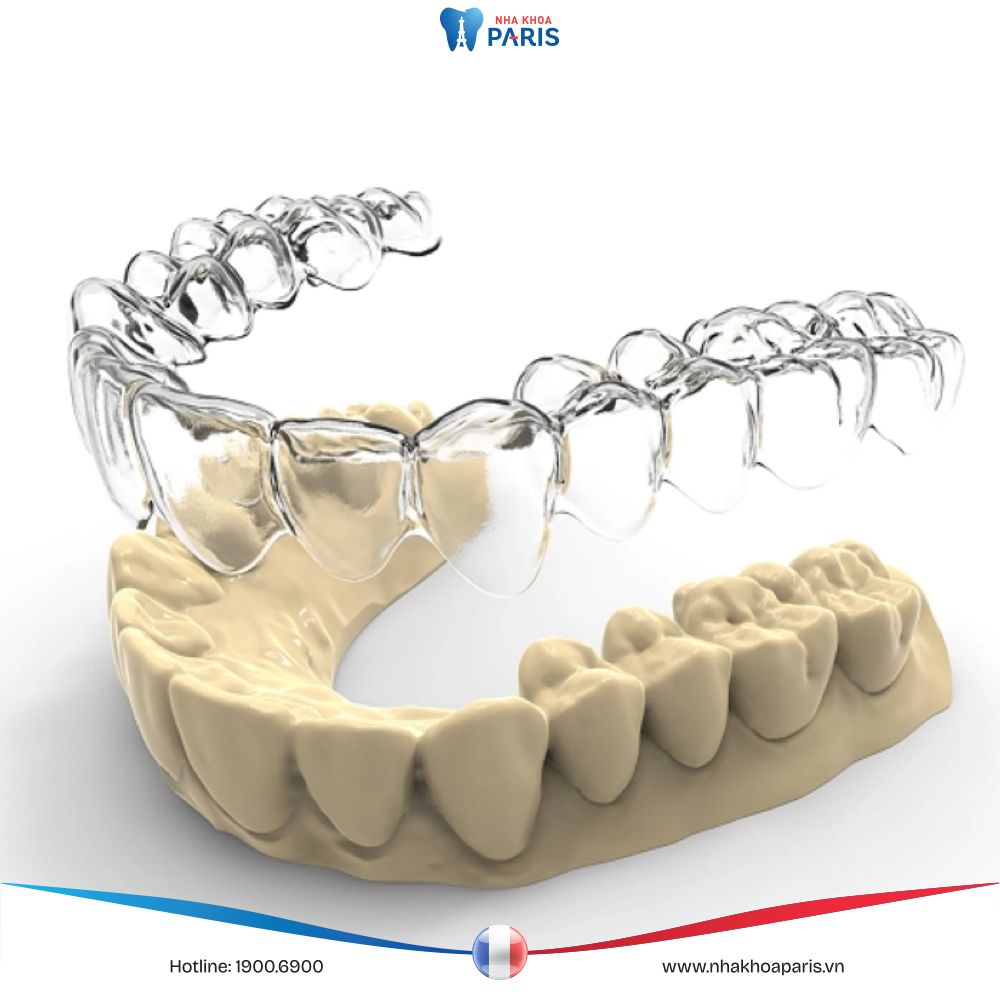 Tại sao lựa chọn Essentials By Invisalign? Điểm đặc biệt là gì